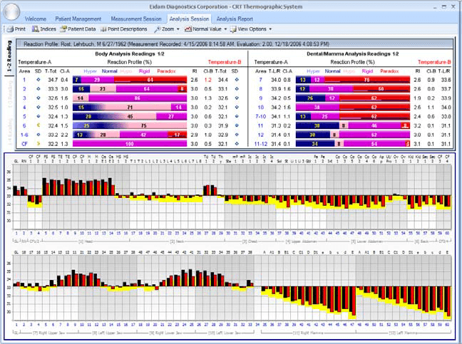 Thermography