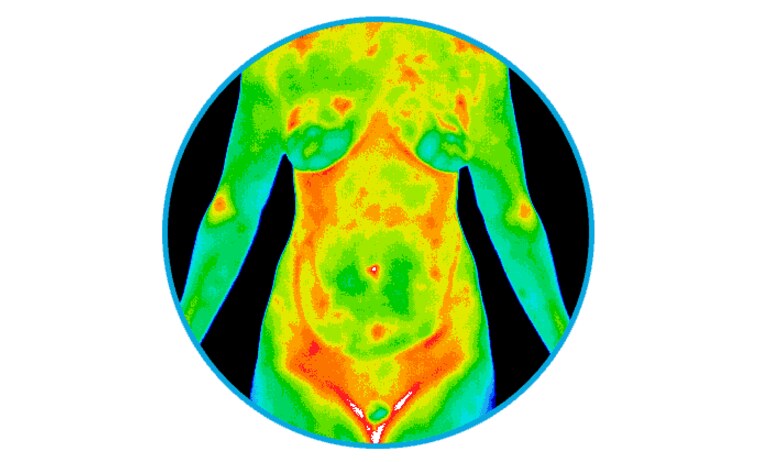 Thermography (digital infrared thermal imaging) scan in Roswell, GA