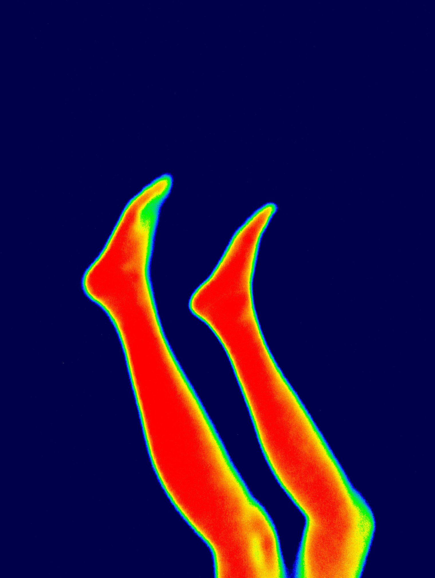 Thermal Image for Early Detection
