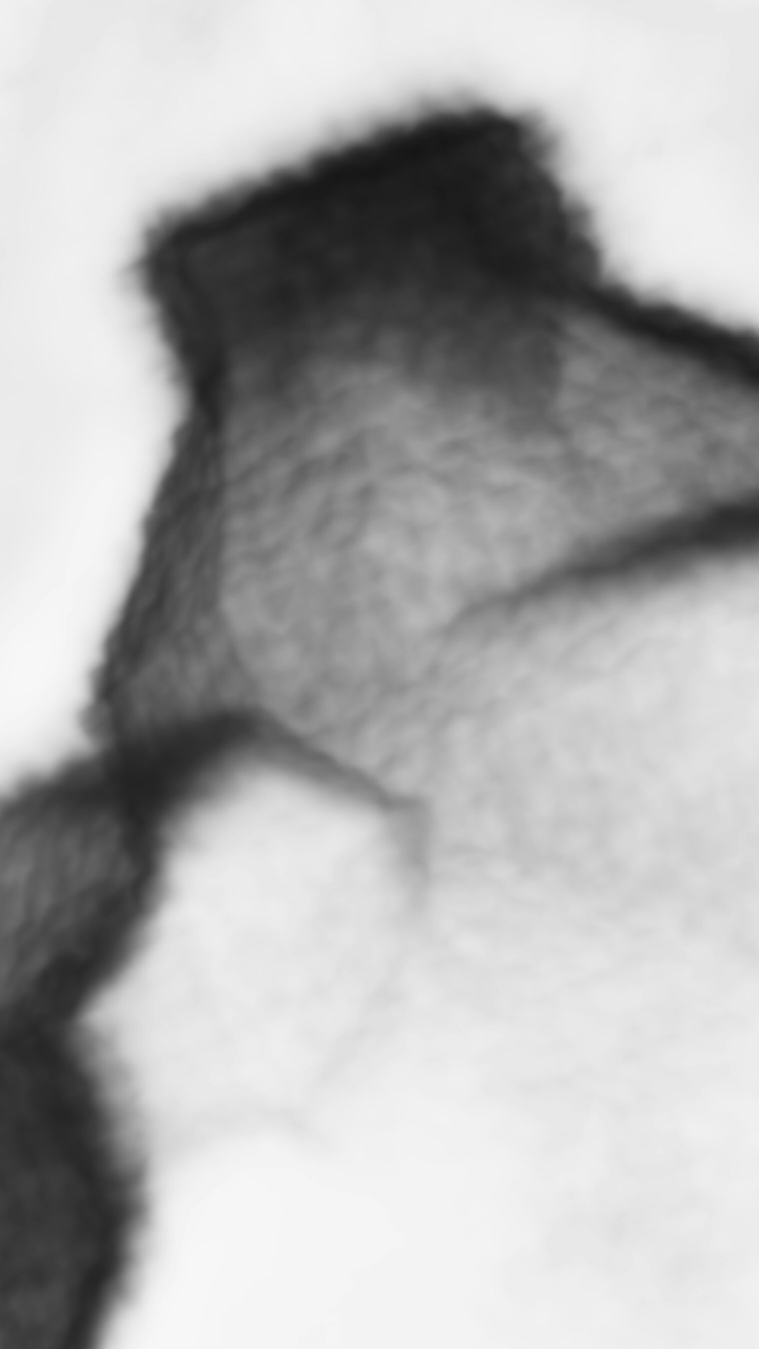 Breast Thermography Image