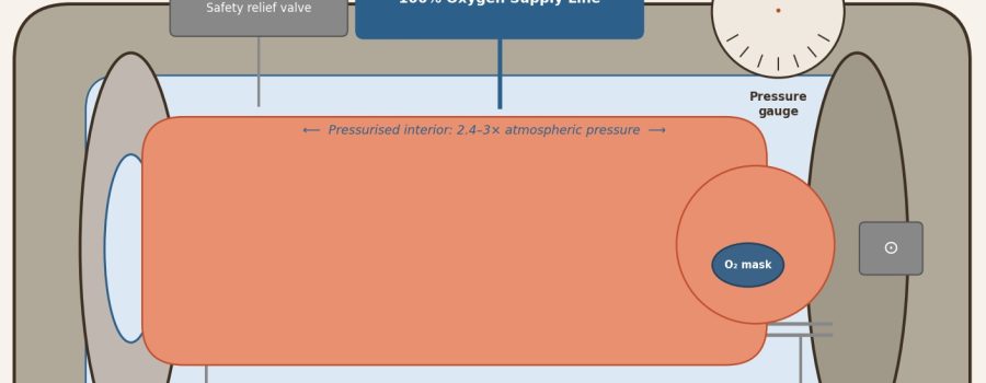 Hyperbaric Oxygen Therapy for Carbon Monoxide Poisoning