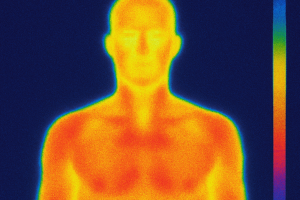 Thermography