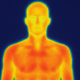 Thermography