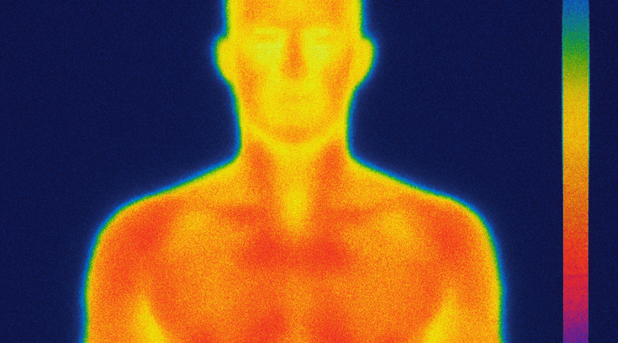 Thermography
